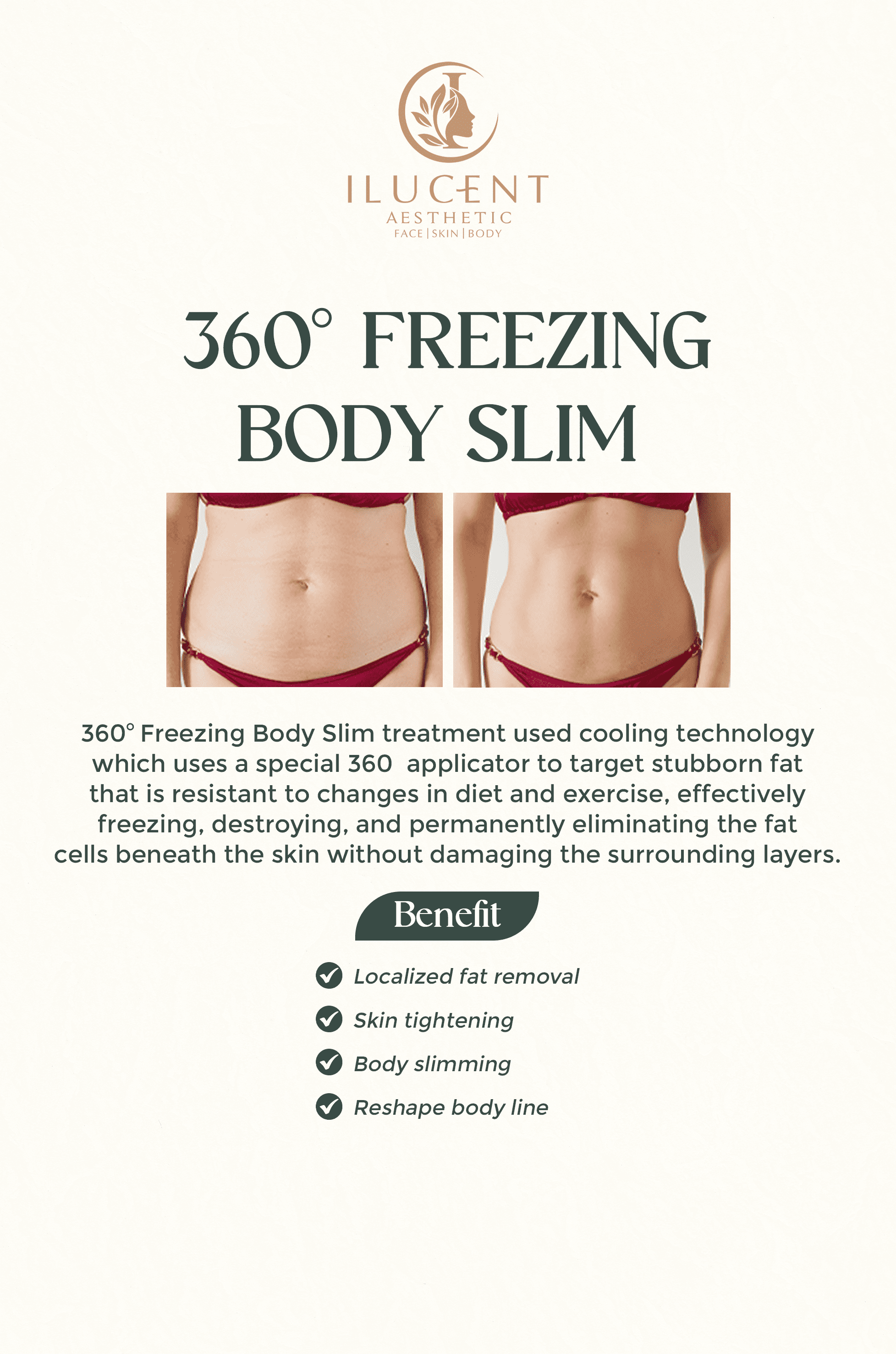 360° Freezing Body Slim
