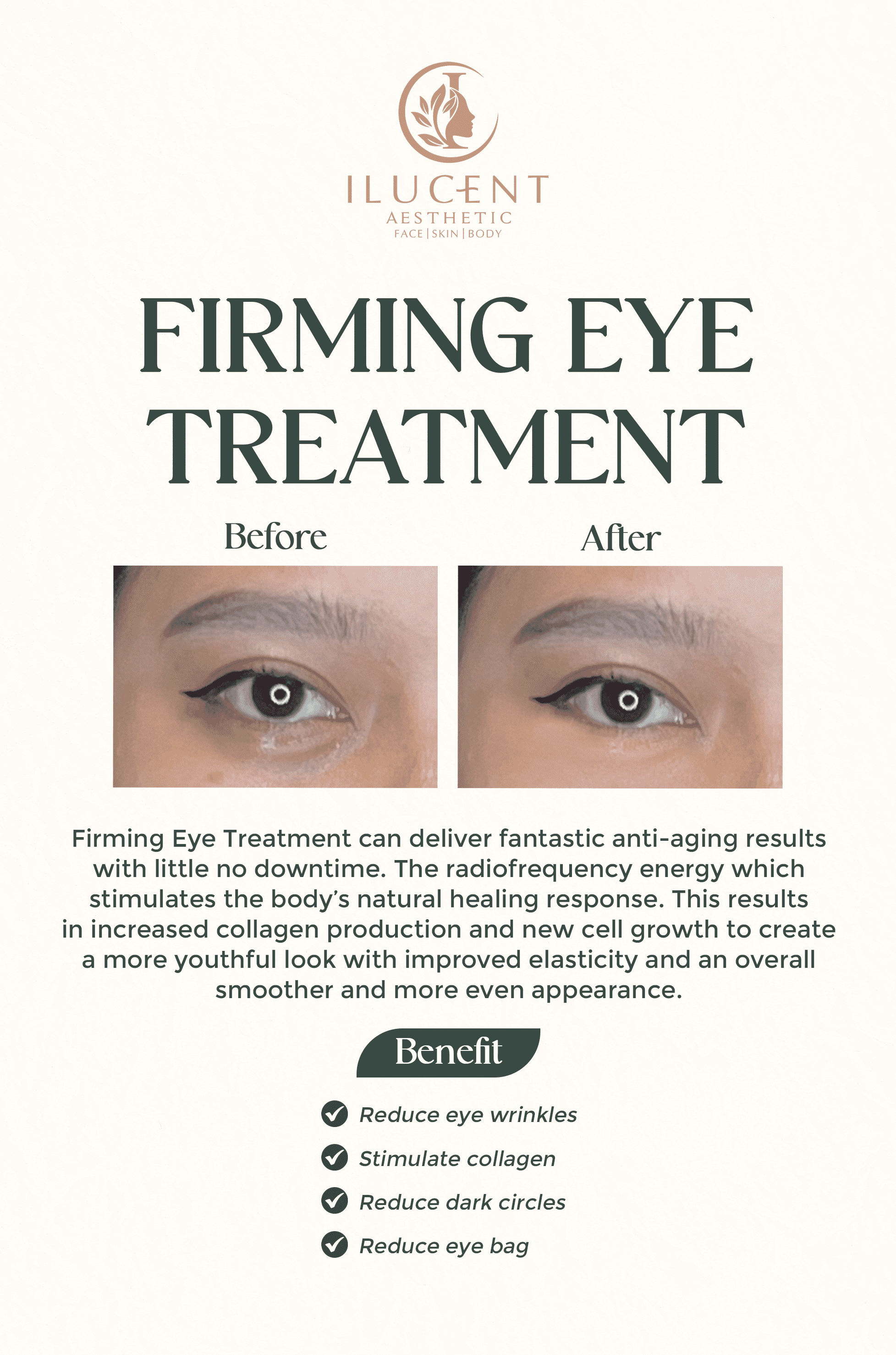Firming Eye Treatment
