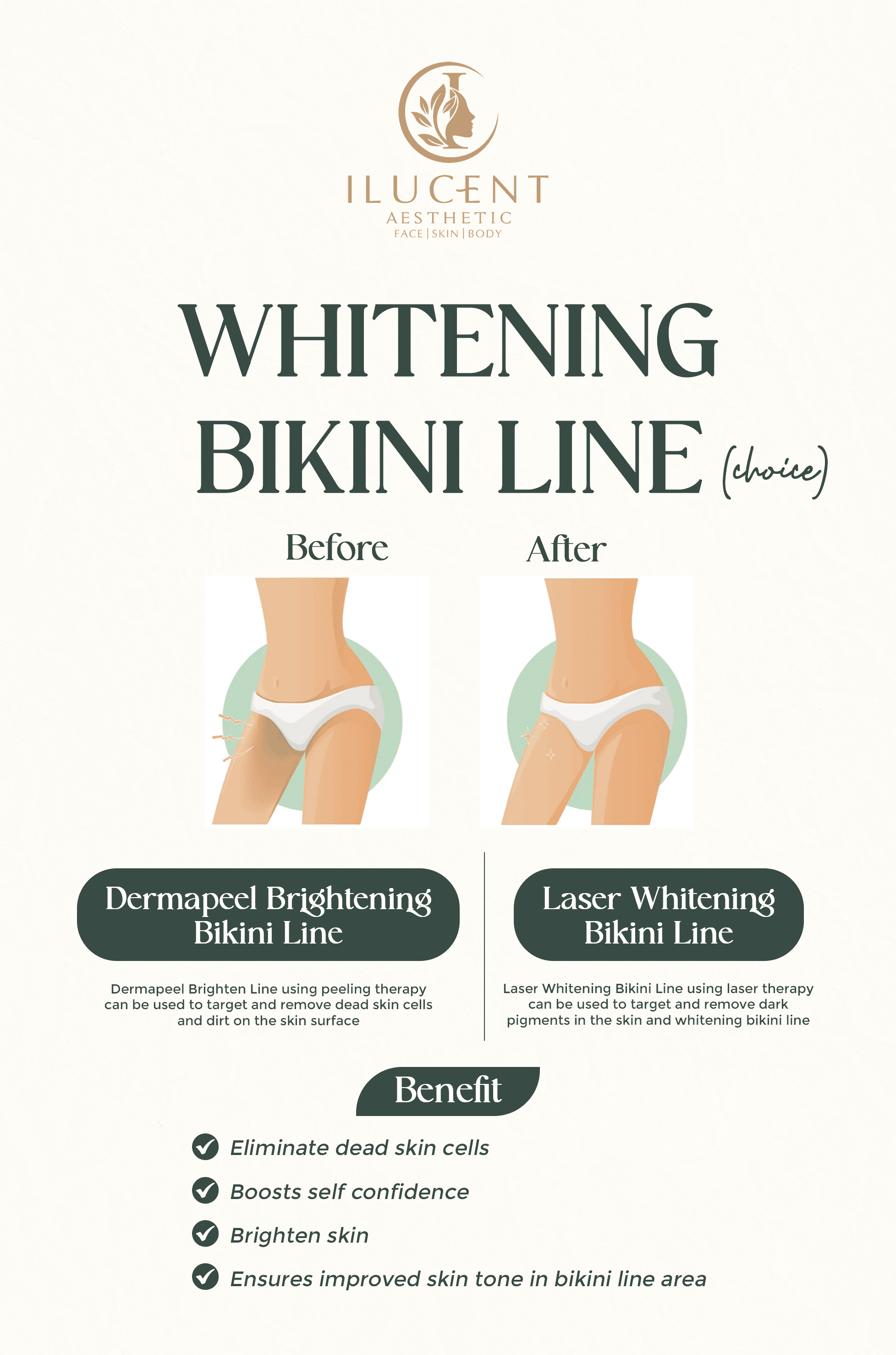 Whitening Bikini Line (Choice)