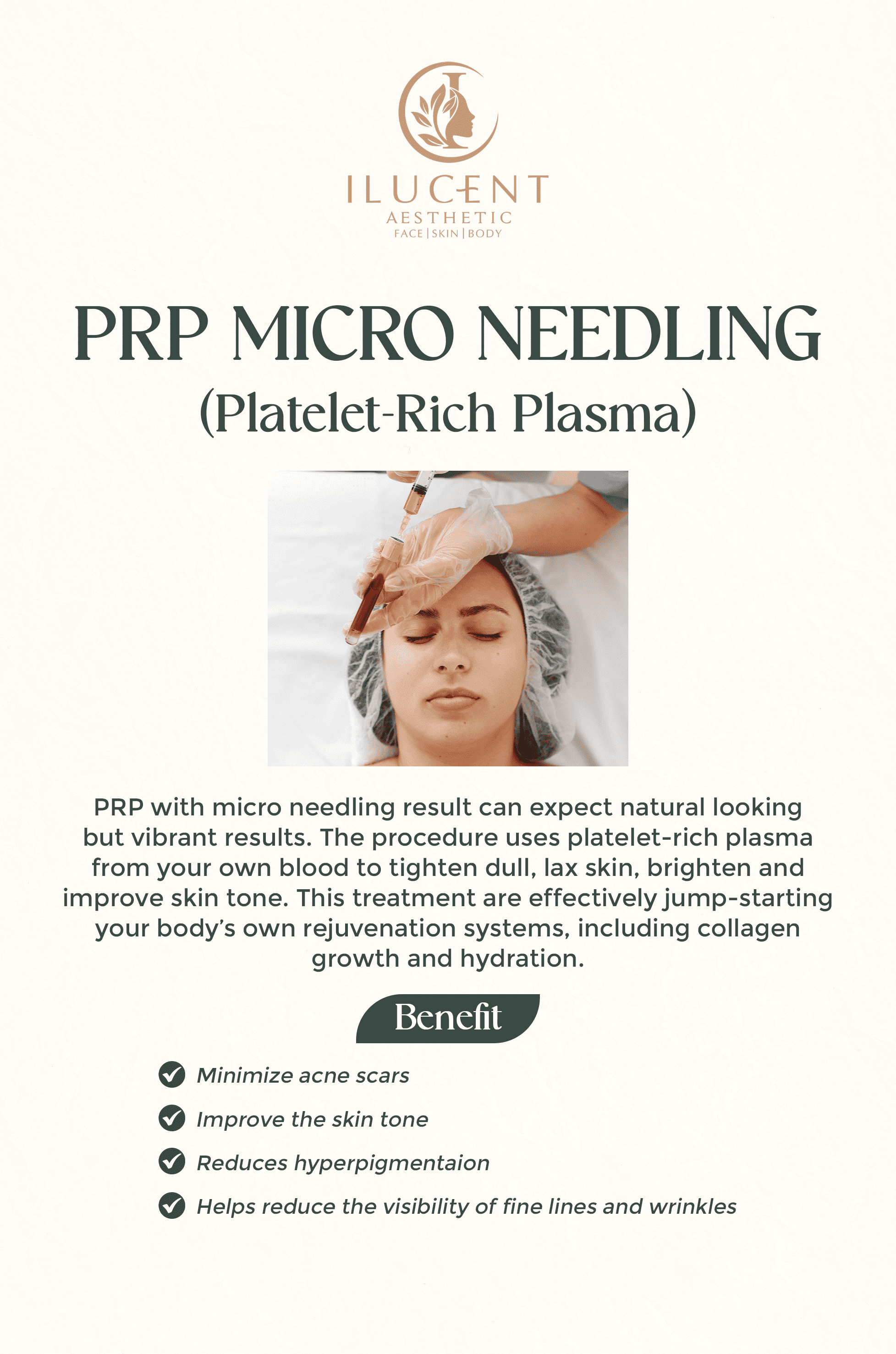 PRP Micro Needling