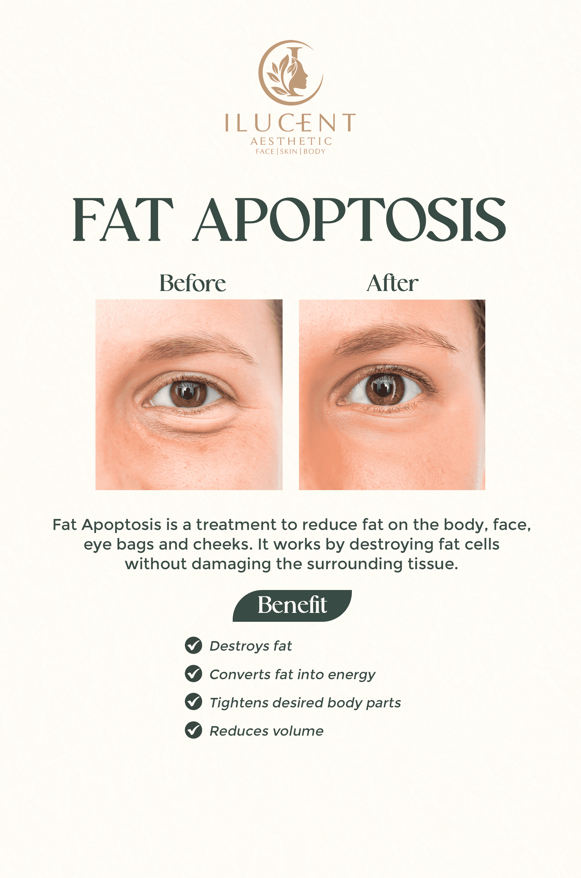Fat Apoptosis