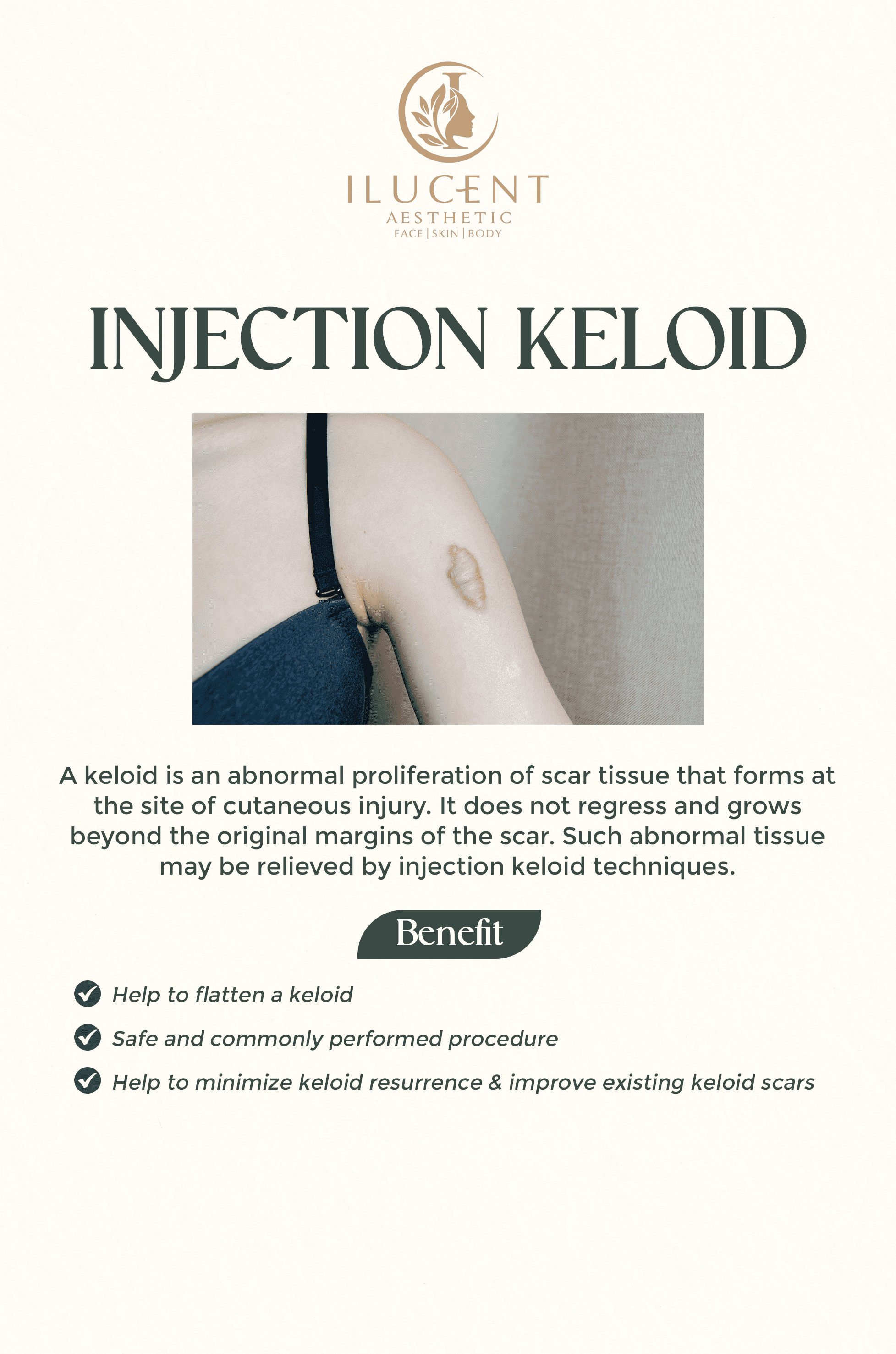 Injection Keloid