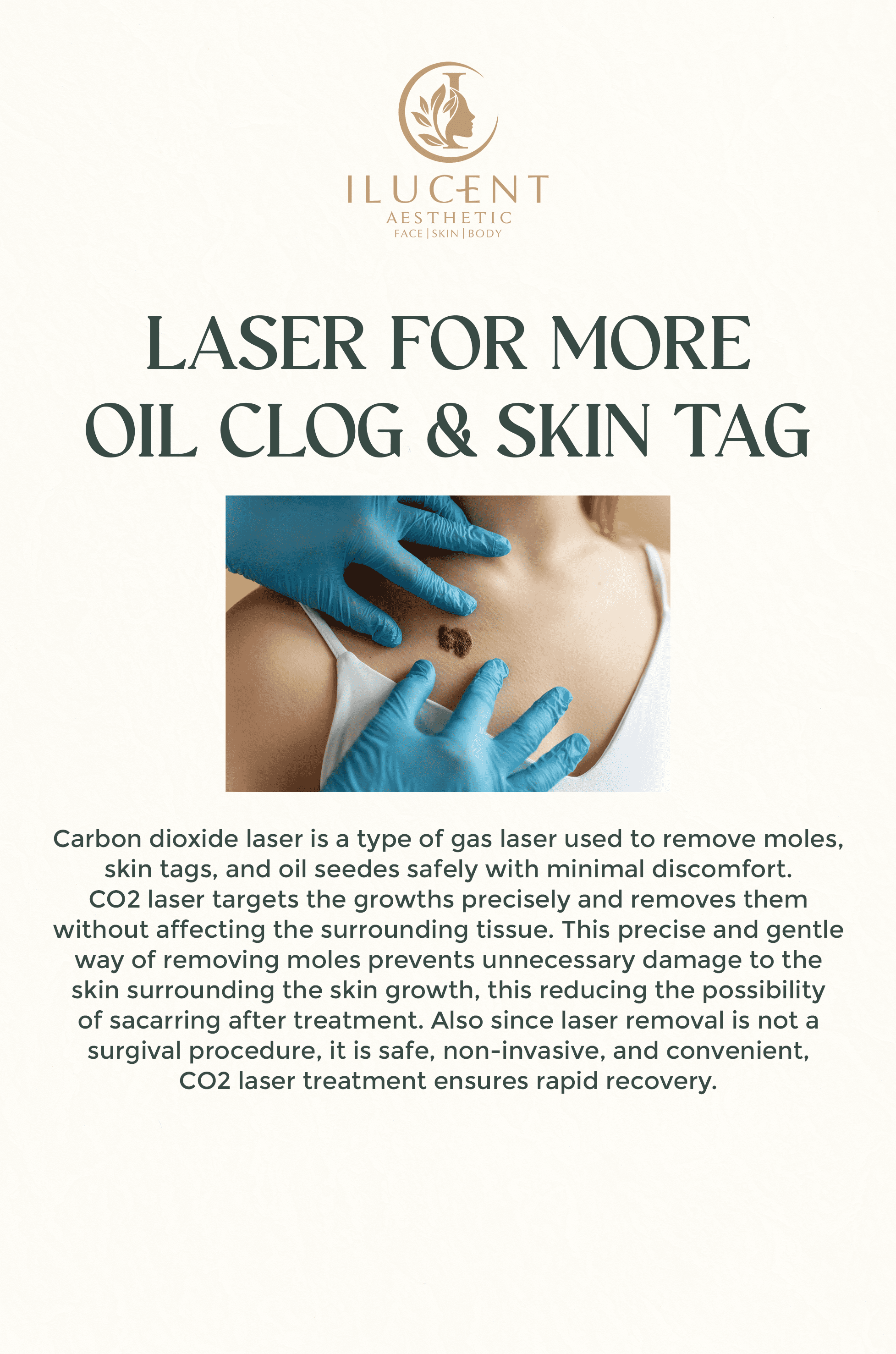 Laser For More Oil Clog & Skin Tag
