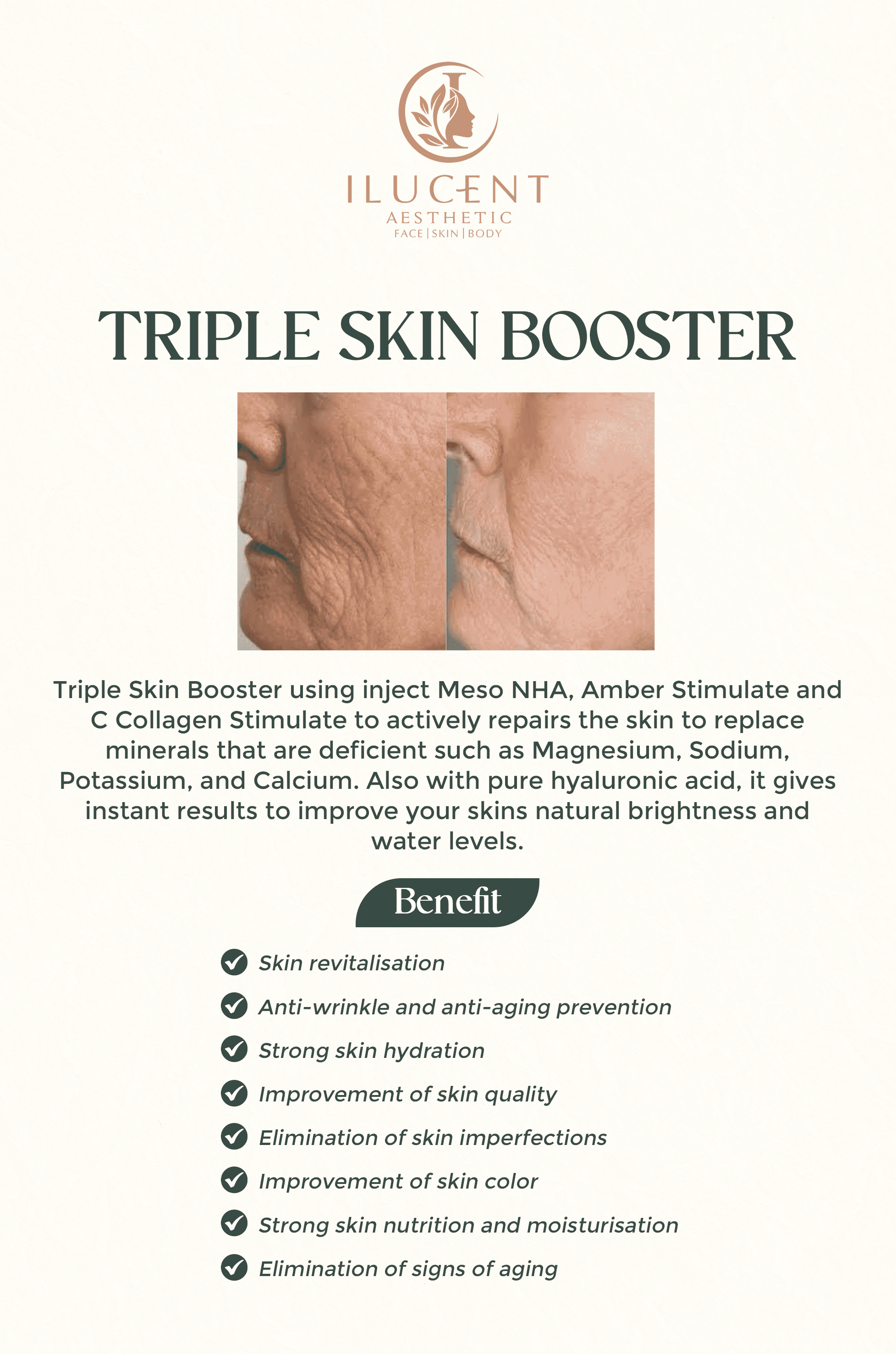 Triple Skin Booster