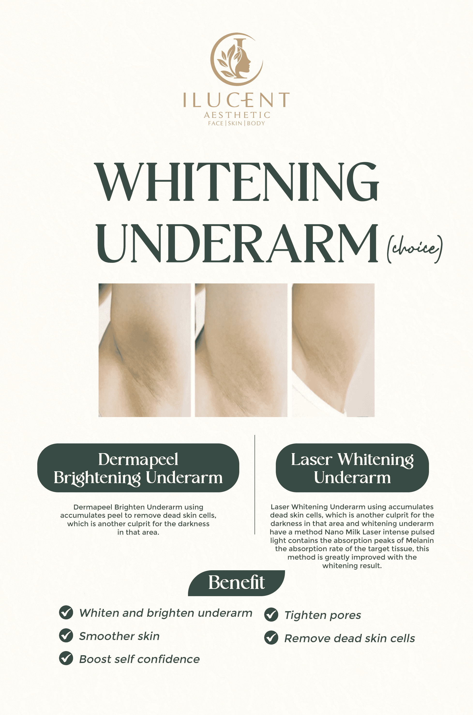 Whitening Underarm (Choice)