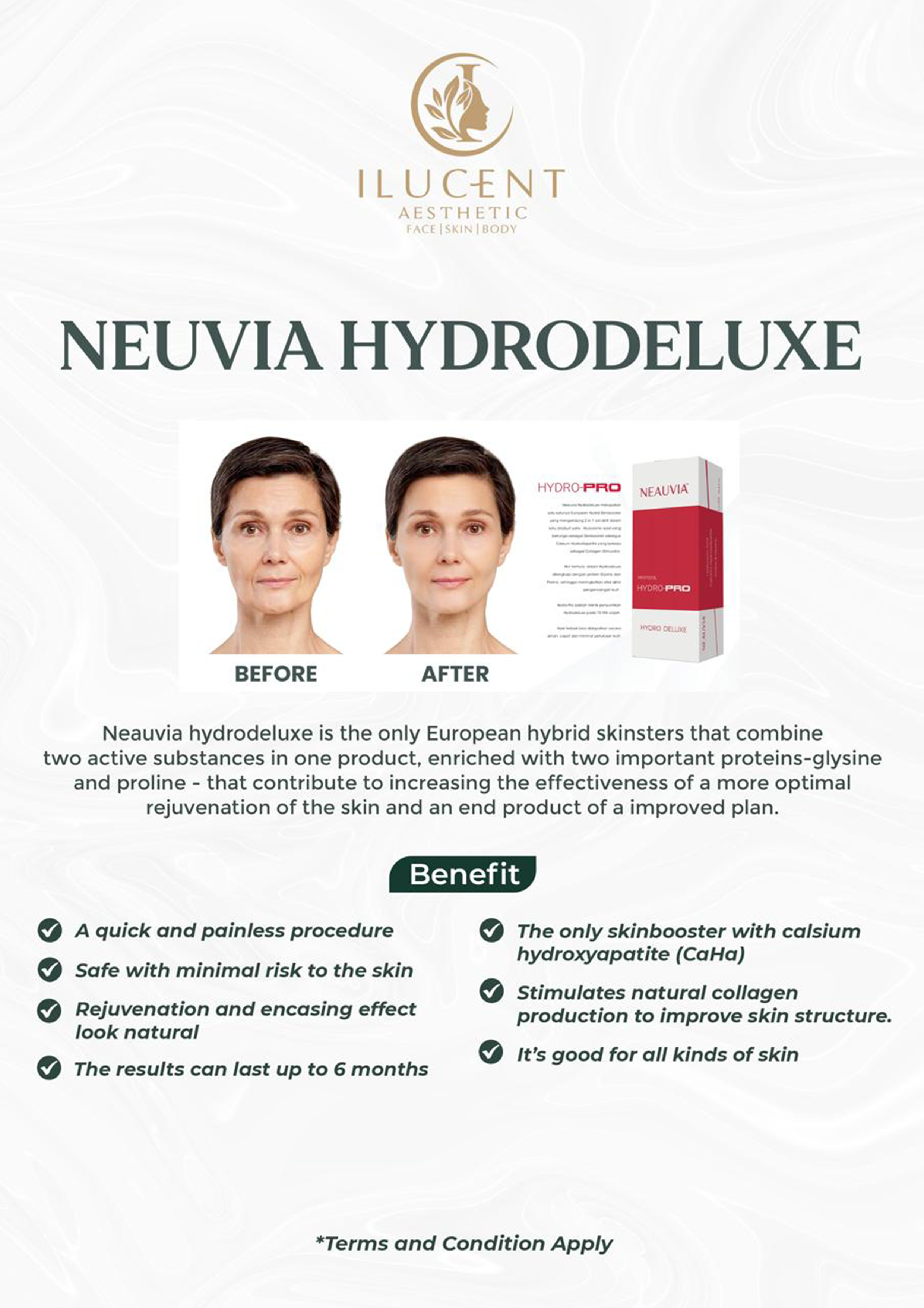 Neuvia Hydrodeluxe