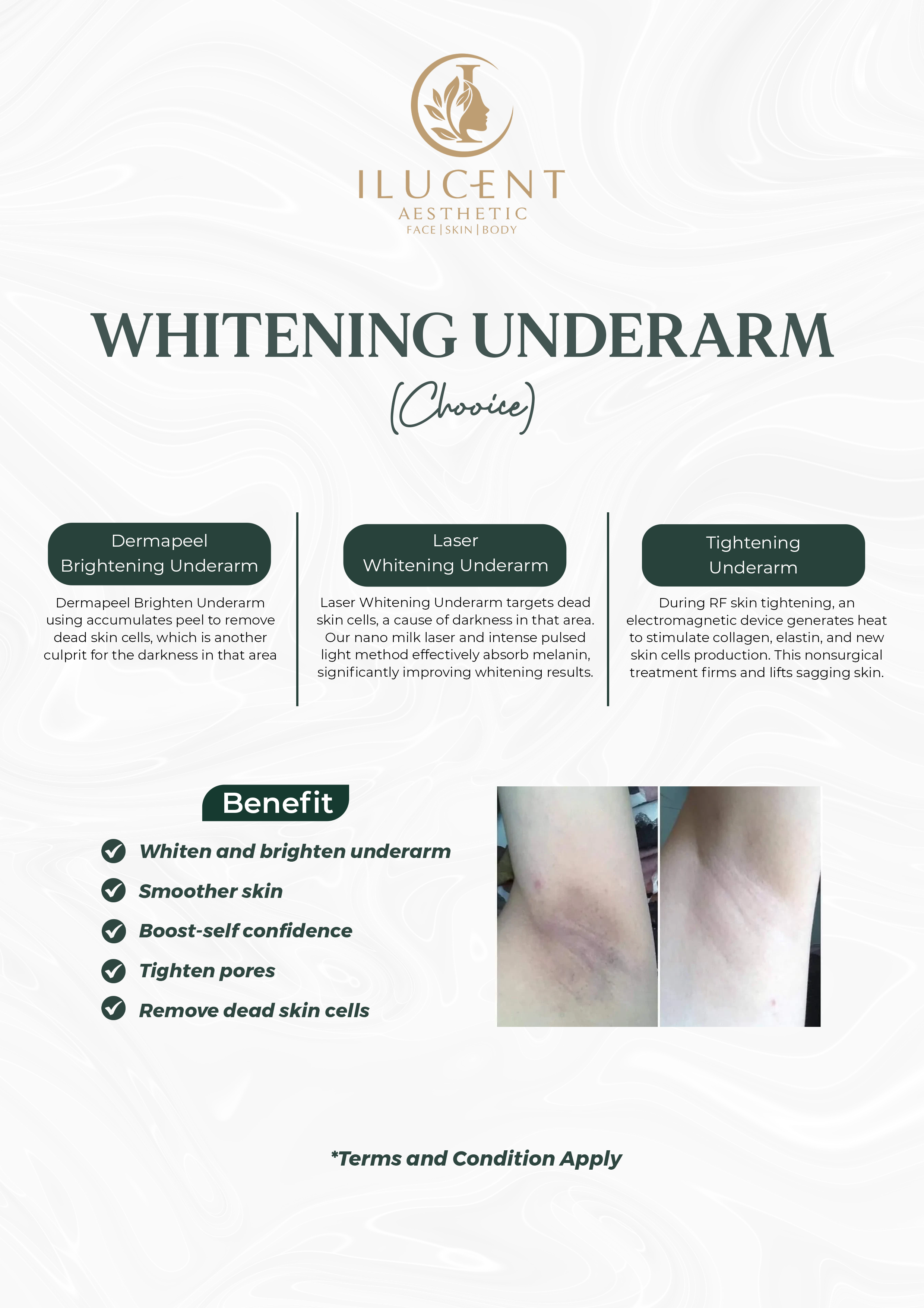Whitening Underarm